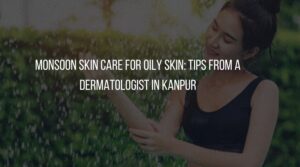 Monsoon Skin Care for Oily Skin: Tips from a Dermatologist in Kanpur