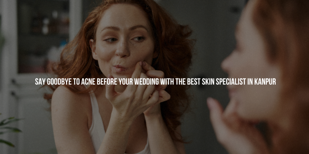 Say Goodbye to Acne Before Your Wedding with the Best Skin Specialist in Kanpur