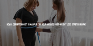 How a Dermatologist in Kanpur Can Help Manage Post-Weight Loss Stretch Marks