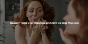 Say Goodbye to Acne Before Your Wedding with the Best Skin Specialist in Kanpur