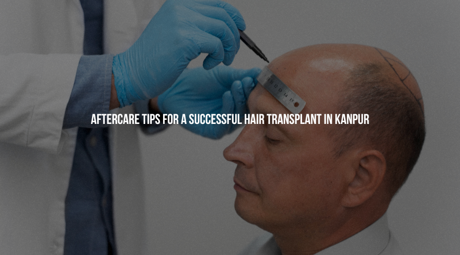 Aftercare Tips for a Successful Hair Transplant in Kanpur